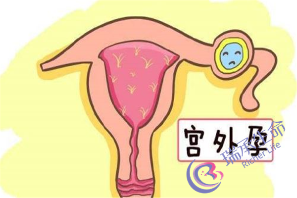 输卵管积水想怀孕怎么办？有哪些方法？
