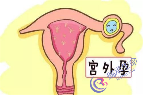男人死精能试管婴儿吗？可以成功怀孕吗？