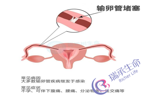 不孕不育医院应该如何选择？都有哪些选择标准？